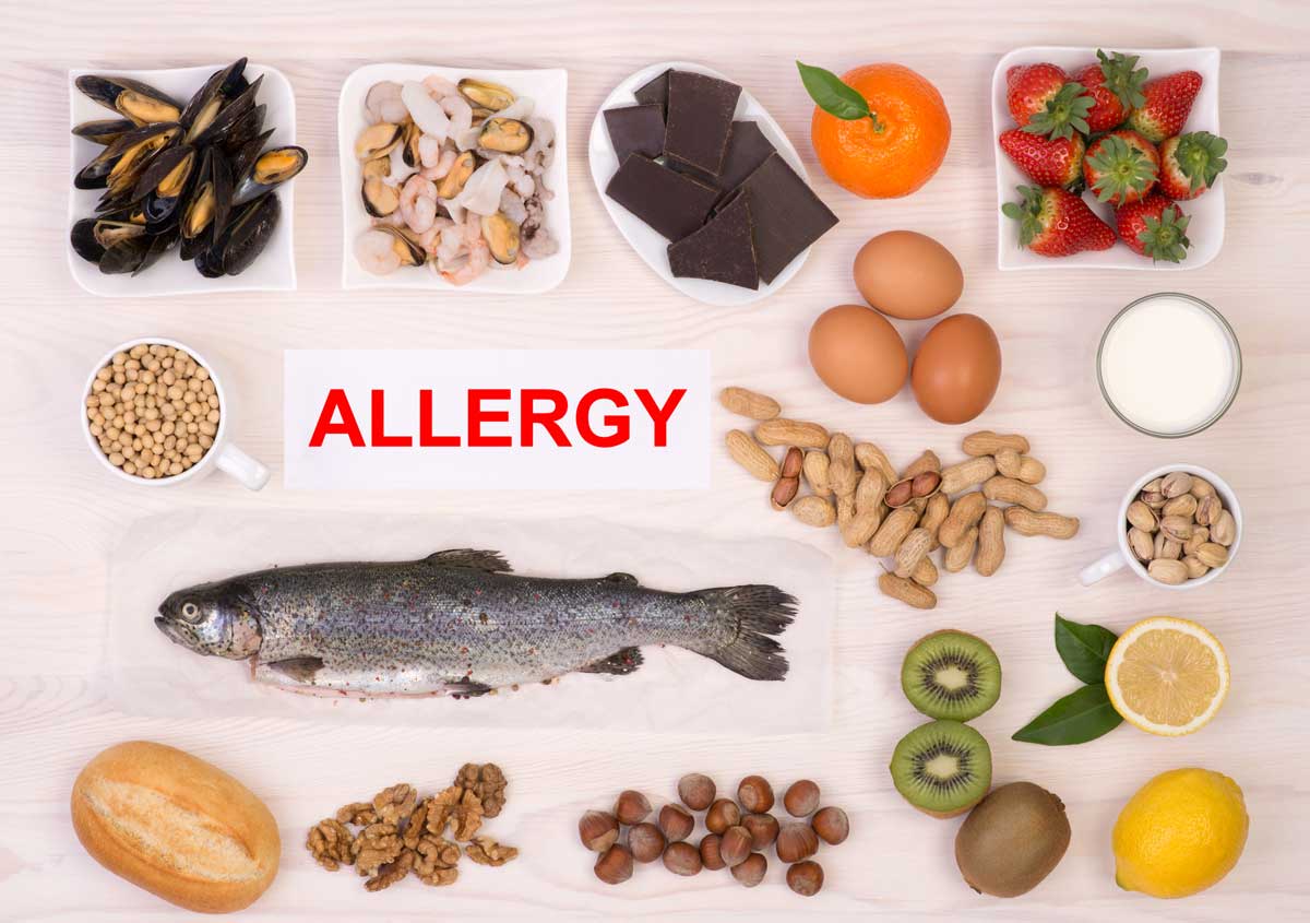 food allergy