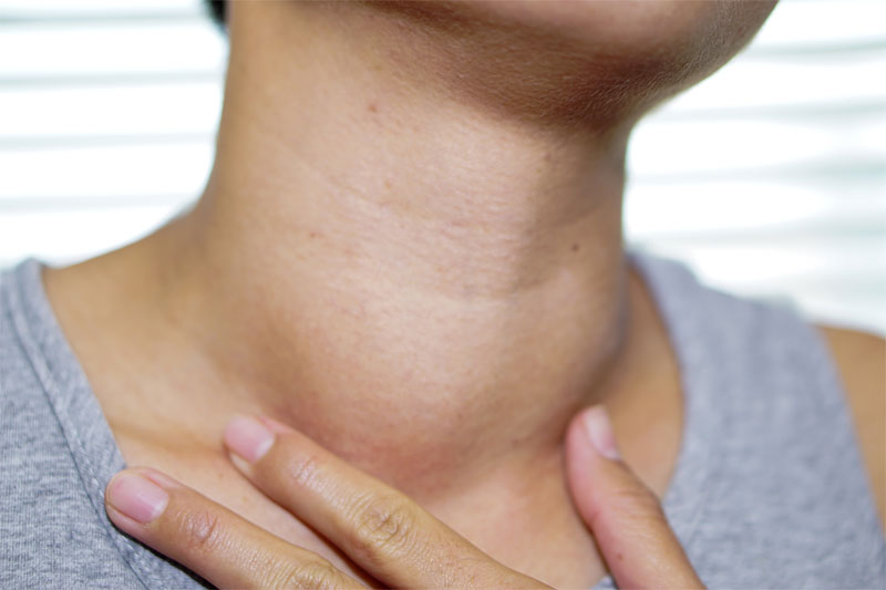 hyperthyroidism symptoms