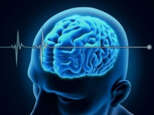 brain death