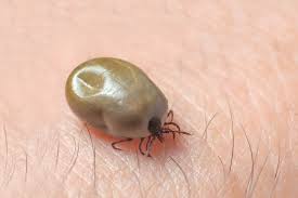 lyme disease